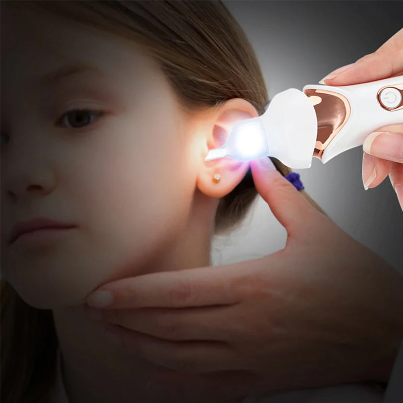 5-in-1 Electric Earwax Remover